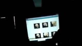 H&N13 middle posterior cranial fossa