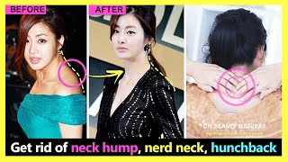 3 Steps Get Perfect Neck posture. Fix Nerd Neck, Neck Hump, Forward Head Posture and Hunchback.