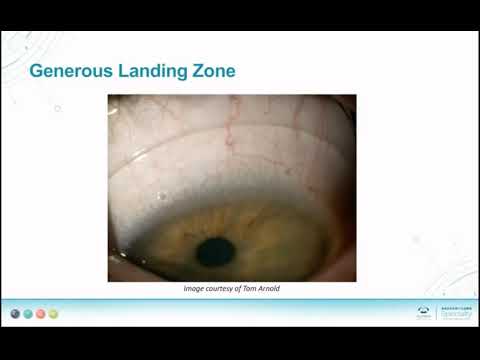 Zen Scleral Lens