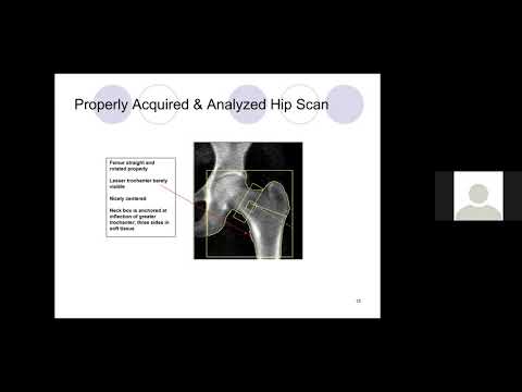 APO DXA Hologic Tech Training