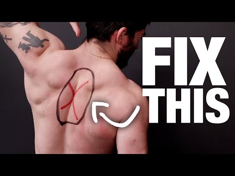 How to Fix Upper Back Pain (NO MORE KNOTS!)