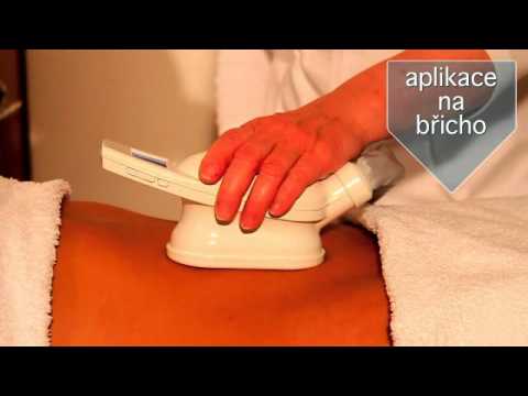 Benefico Spa* - Kryolipolýza - nejnovější liposukce zmražením!