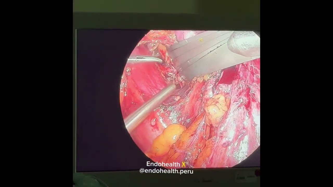 Gianmarco Ramirez Gonzales-4