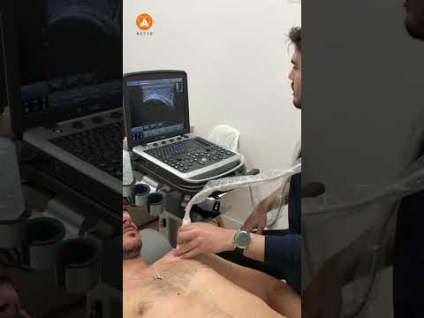 Fernando Casquero Ojea-4