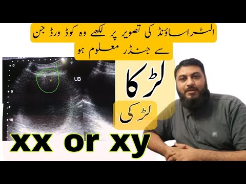 Gender before birth | XX | XY | Urdu Hindi