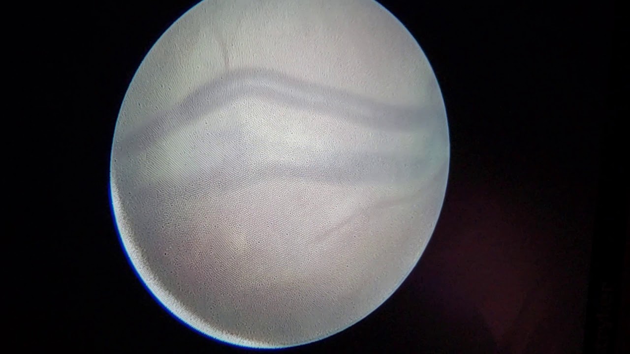 Miguel Parra Saavedra-13