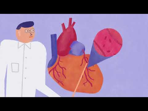 Ischaemiás szívbetegség rehabilitációja - KardioKözpont Magas vérnyomás ischaemiás szívbetegség