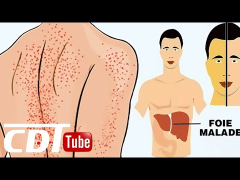 5 signes que votre corps vous envoie quand votre foie va mal | CDT NEWS