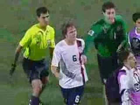 Handbags USA vs Uruguay