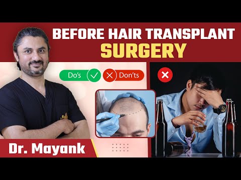 ✅Do's & Don't Before Hair Transplant Surgery | Everything You Need to Know Before Hair Transplant