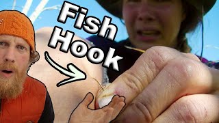 5 Ways How To Remove A Fish Hook, Alone Season 5 Episode 1 Mongolia Carleigh’s Hook Removal