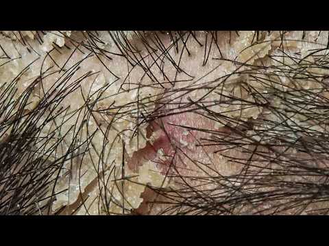 Ultimate Relaxation with Comb #DKMO3773