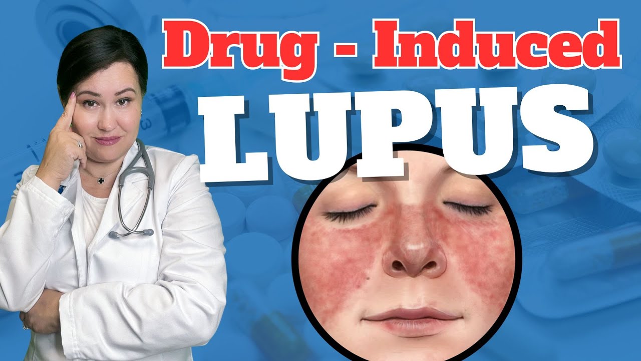 What is the difference between lupus and druginduced lupus? More REF