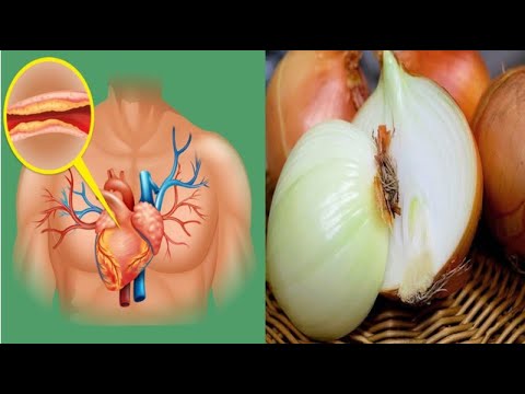 Publikohet studimi më i fundit, ky mineral që gjendet tek qepa lufton këto probleme shëndetësore ...