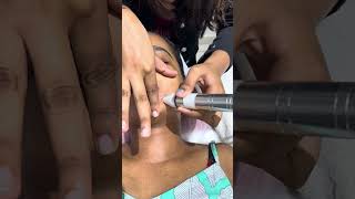 Hydra Fusion Facial Two