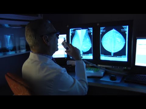 Diep Flap Breast Reconstruction