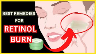 How to Treat a Retinol Burn | Retinol Serum Tips and Tricks | Get Rid of Retinol Burn