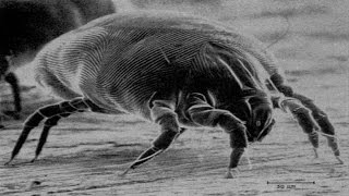 15 Ways to Get Rid of DUST MITES Quickly