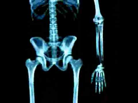 Artrite massaggio congiunta Ginocchio artroplastica prezzo Krasnoyarsk