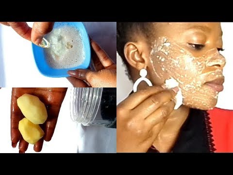 Easily Remove Dark Spots In A Single Night Clear...