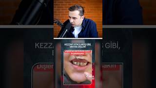 KEZZAP DÖKÜLMİŞ GİBİ ERİYEN DİŞLER