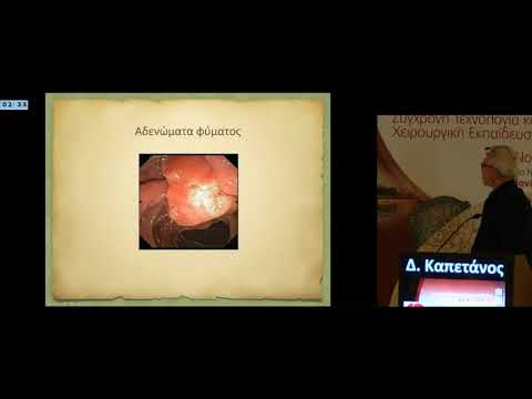 Δ Καπετάνος - Ενδοσκοπική αντιμετώπιση και παρακολούθηση;