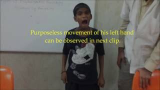 Sydenham&#39;s chorea in 10 year old boy