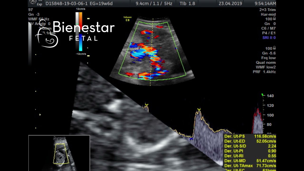 Jose Carlos Gutierrez Gutierrez-2