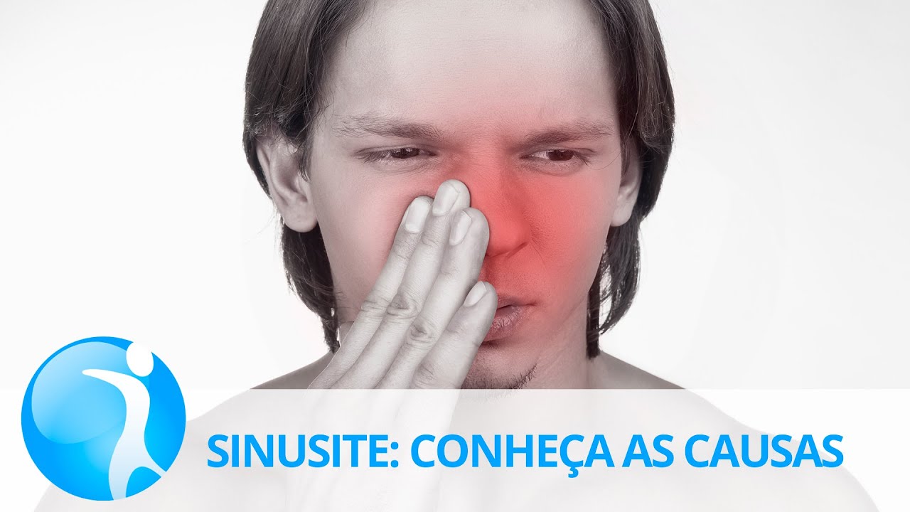 Watch Now Sinusite: dores na cabeça e no rosto indicam doença respiratória Sinusite: dores na cabeça e no rosto indicam doença respiratória