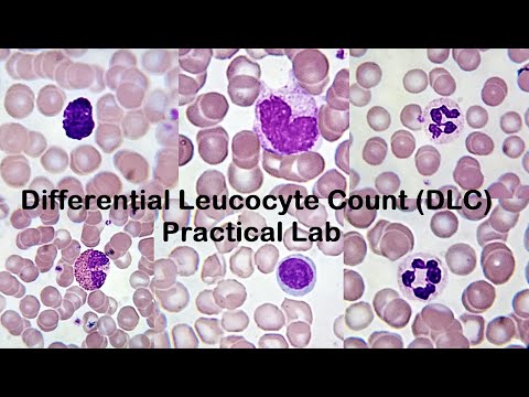 Differential Leucocyte Count DLC Practical Lab