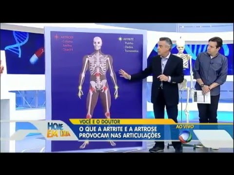 Artrite e artrose: saiba como prevenir e tratar no Você e o Doutor