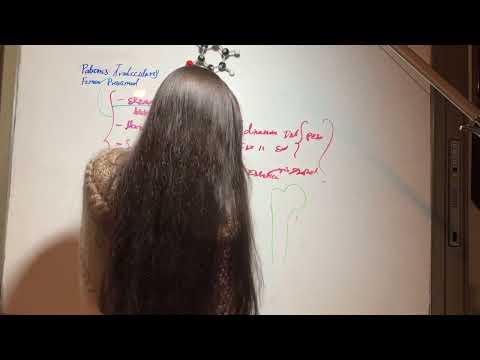 Trabecular Patterns of the Proximal Femur. Hip Prosthesis. Orthopedics and Traumatology