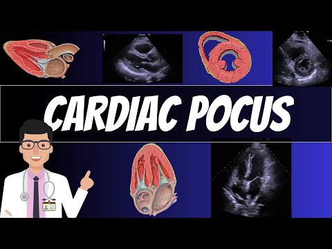 CARDIAC POINT OF CARE ULTRASOUND (POCUS)