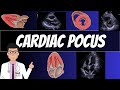 CARDIAC POINT OF CARE ULTRASOUND POCUS