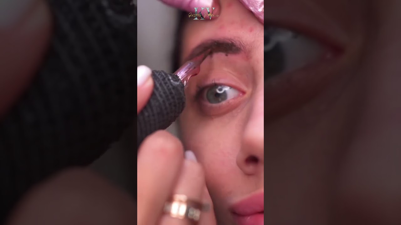 Tu rostro no es un experimento. Invierte en calidad, no en correcciones.