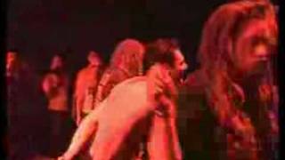 HAEMORRHAGE Im A Pathologist