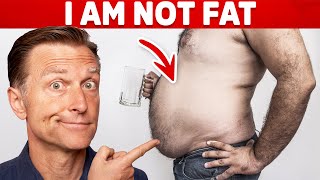 Huge Belly but NOT Fat? – Dr.Berg On Cirrhosis & Ascites