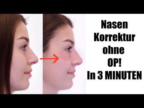 download lagu mp3 mp4 Nasenkorrektur Ohne Op, download lagu Nasenkorrektur Ohne Op gratis, unduh video klip Nasenkorrektur Ohne Op