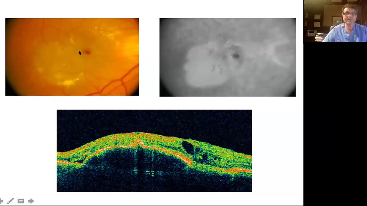 Retinal OCT for Clinicians