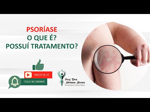 Psoríase - o que é e como tratar?