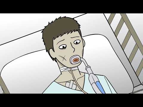 My Coma Experiences Story Animated