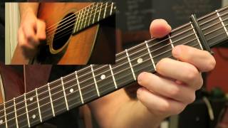 Stoney Lonesome - Flatpicking Guitar Lesson