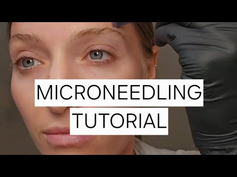Microneedling Tutorial w/ Licensed Aesthetician