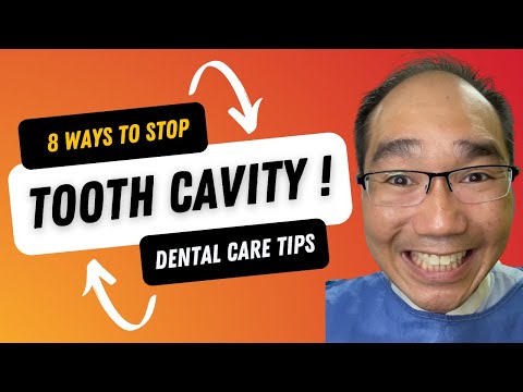 Tooth decay prevention video thumbnail