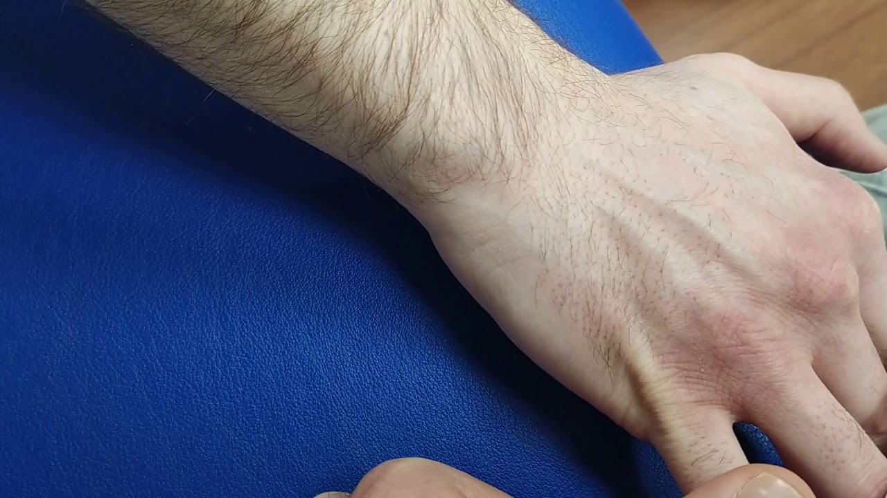 Palpazione dell estensore proprio del mignolo