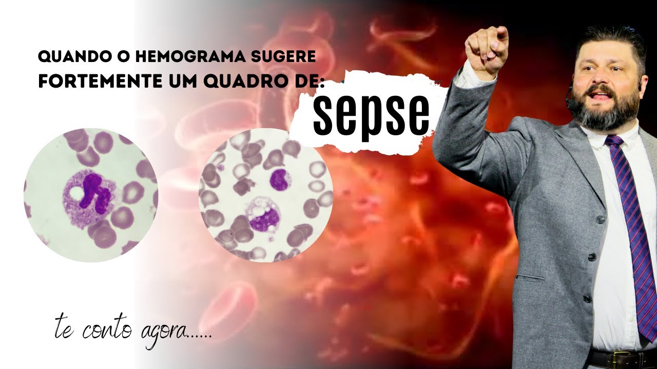 VACUOLO DE CITOPLASMA DE NEUTROFILOS - indicador de sepse