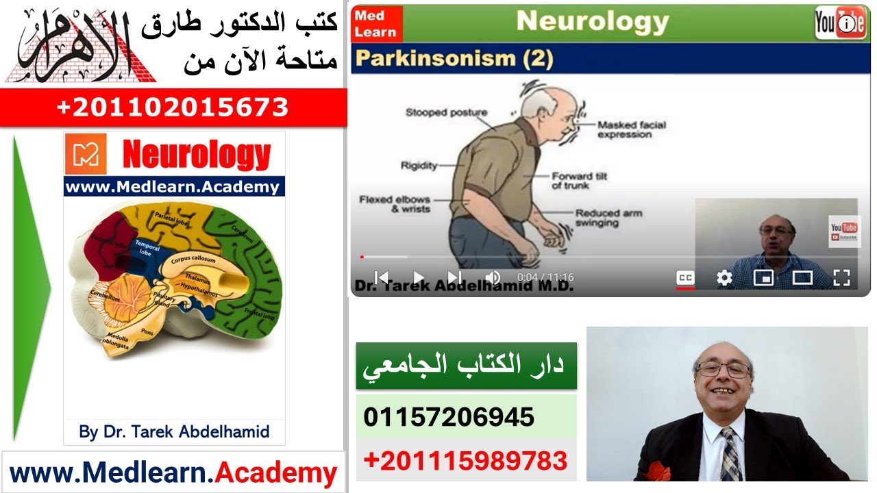 Parkinsonism (Part 2)