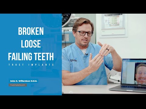 Dental implants: Upper and lower Zirconia All-on-6 case of the Day Trust Implants.