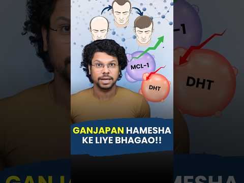 Reverse Genetic Hair Loss with this treatment | Hair Fall | Hair Thinning | DHT Blocker #waidon