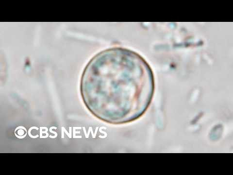 Michigan health official details effort to mitigate cyclosporiasis outbreak